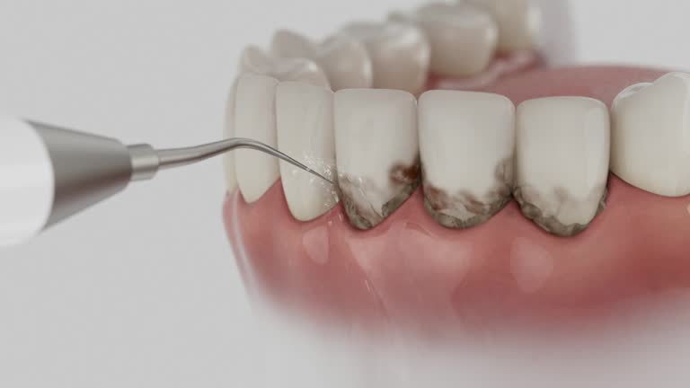 Trusted Invisalign Clear Aligners service in Lincoln, AL - Dentist Open Now